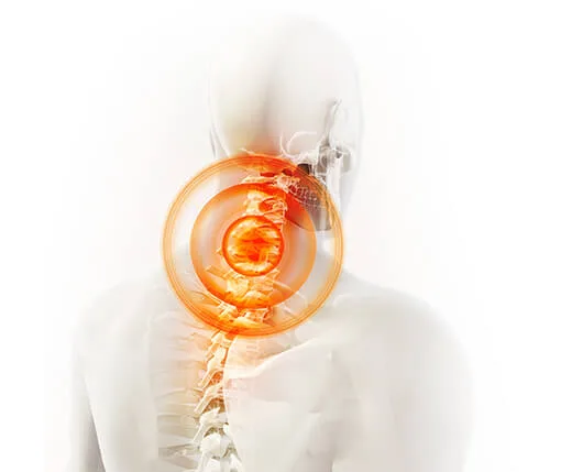 Ilustración de dolor articular en rodilla que Flexacil Ultra apoya a reducir