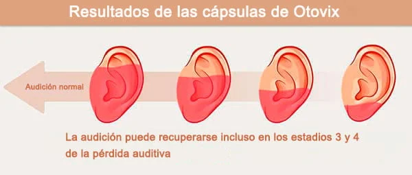 Resultados de Otovix: antes y después en calidad auditiva y reducción de tinnitus